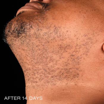 model after 14 days without razor bumps