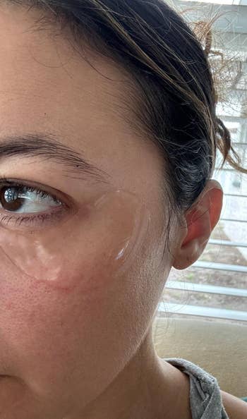 Woman with under-eye gel spot  applied, close-up