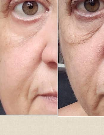 a reviewer's before and afters showing significantly less puffiness under their eye
