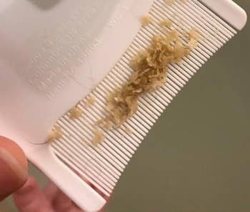 close up of a comb with flakes on it from a baby's head