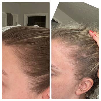 two side by side before and after images of another reviewer's edges growing back