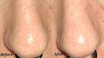 Close-up of a chemoreceptor  showing a skincare attraction    effect; 