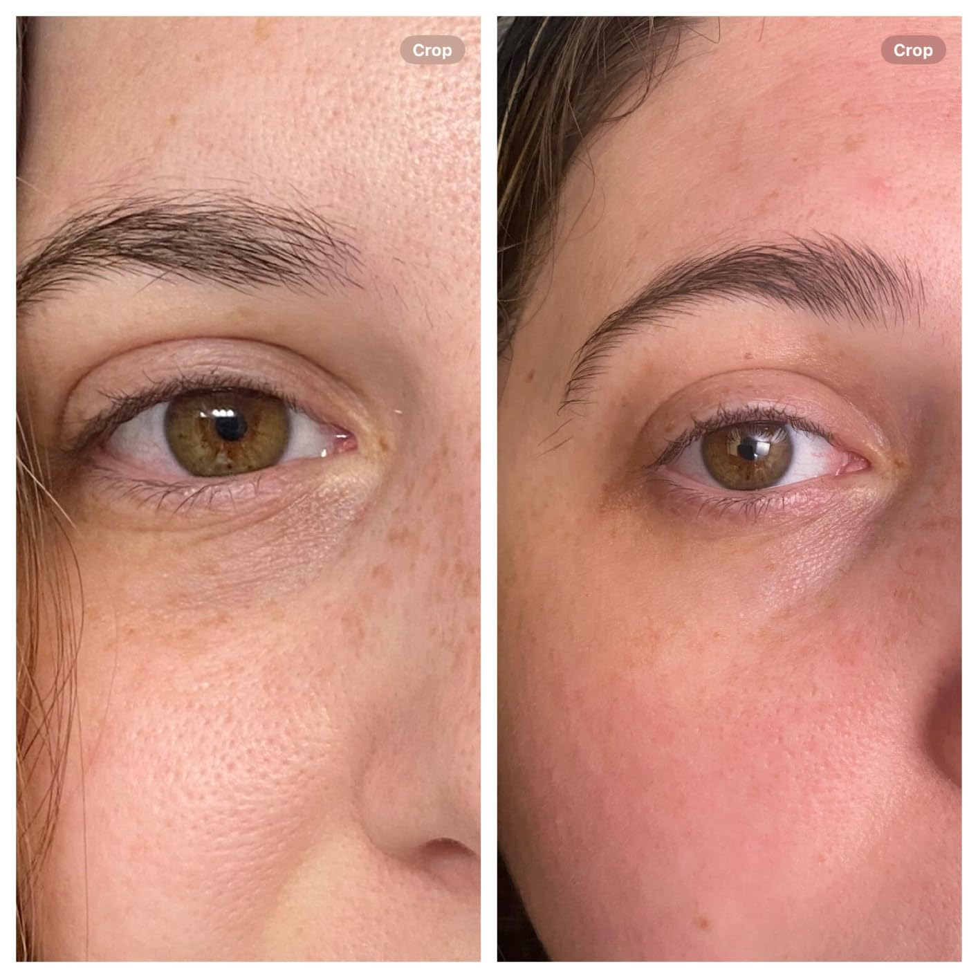 before/after of reviewer's face after using the serum