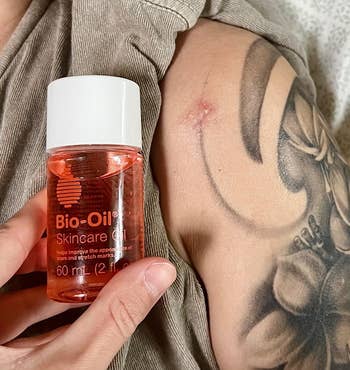 A reviewer holds a 2 fl oz bottle of Bio-Oil Skincare Oil next to their tattooed arm, which has a healing scar