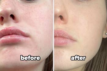 before/after showing brighter, more even looking skin tone after using the serum