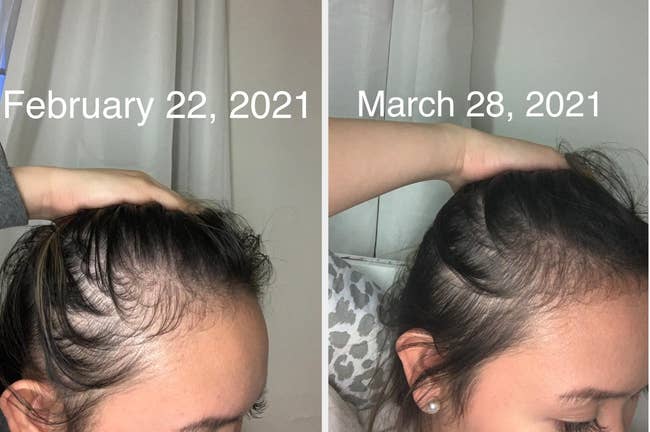 Before and after photos of a person's hair growth from February 22 to March 28, 2021