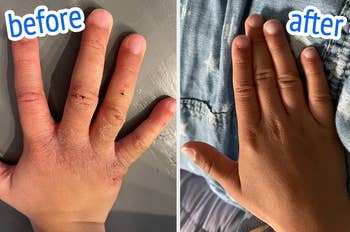 Reviewer photo of hands before and after using soap