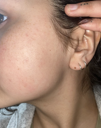 same reviewer after removing peach fuzz with razor