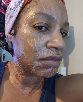 reviewer showing the wrinkles and texture of the zombie face mask on their skin