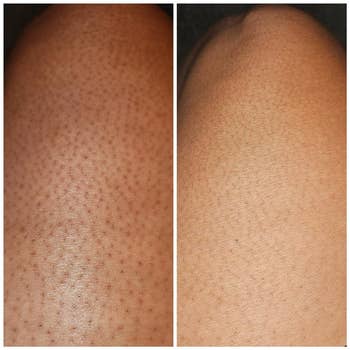 reviewer's thigh before and after using scrub