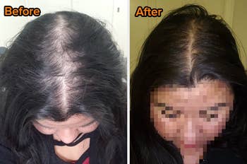 Reviewer showing scalp with black hair before and after using products
