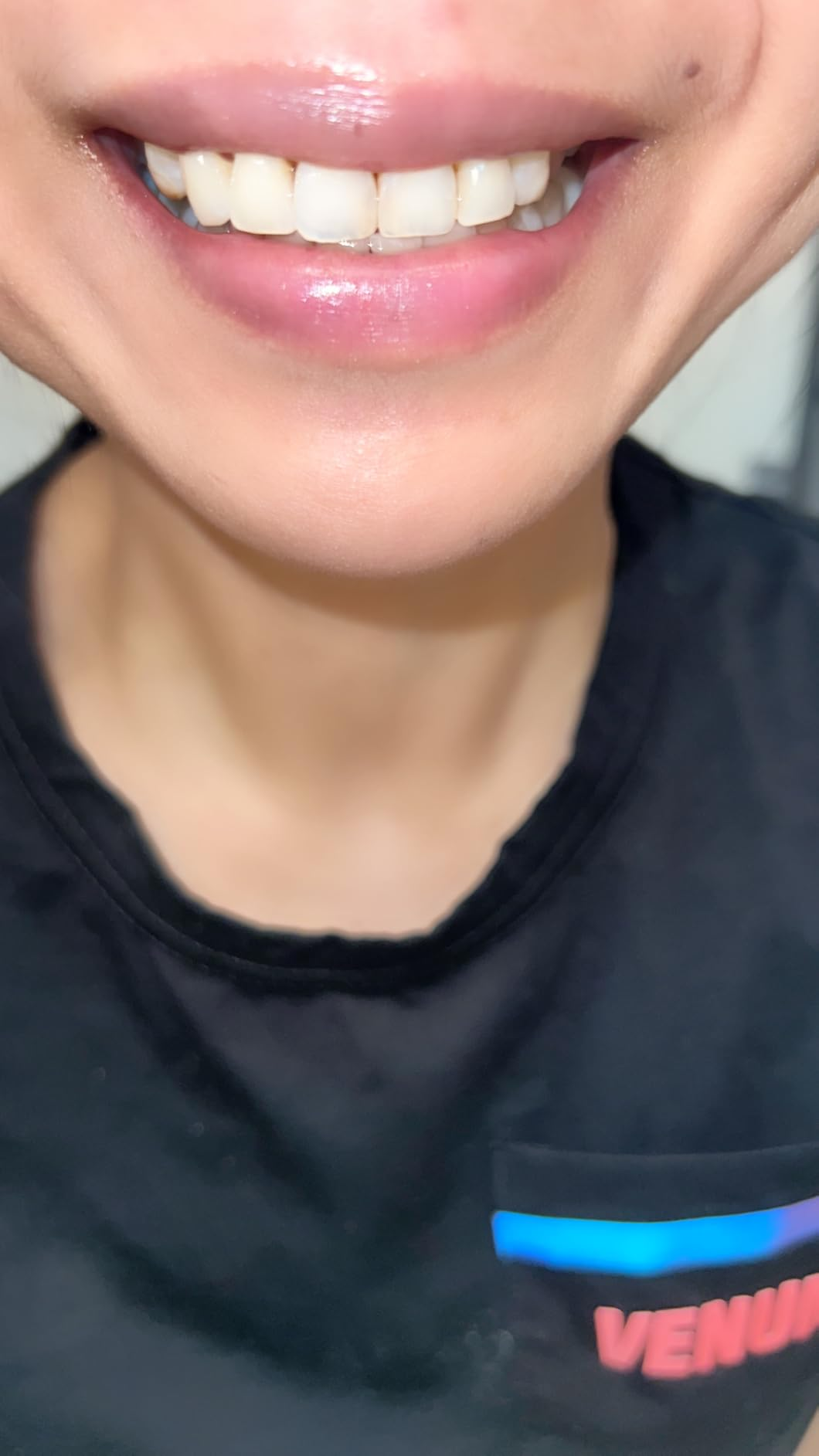 Close-up of a reviewer's lips showing articulator  balm