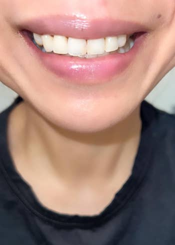 Close-up of a reviewer's lips showing articulator balm