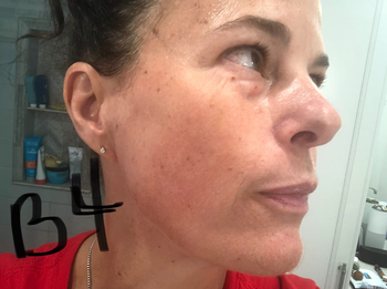 reviewer's side of face with crow's feet and fine lines visible