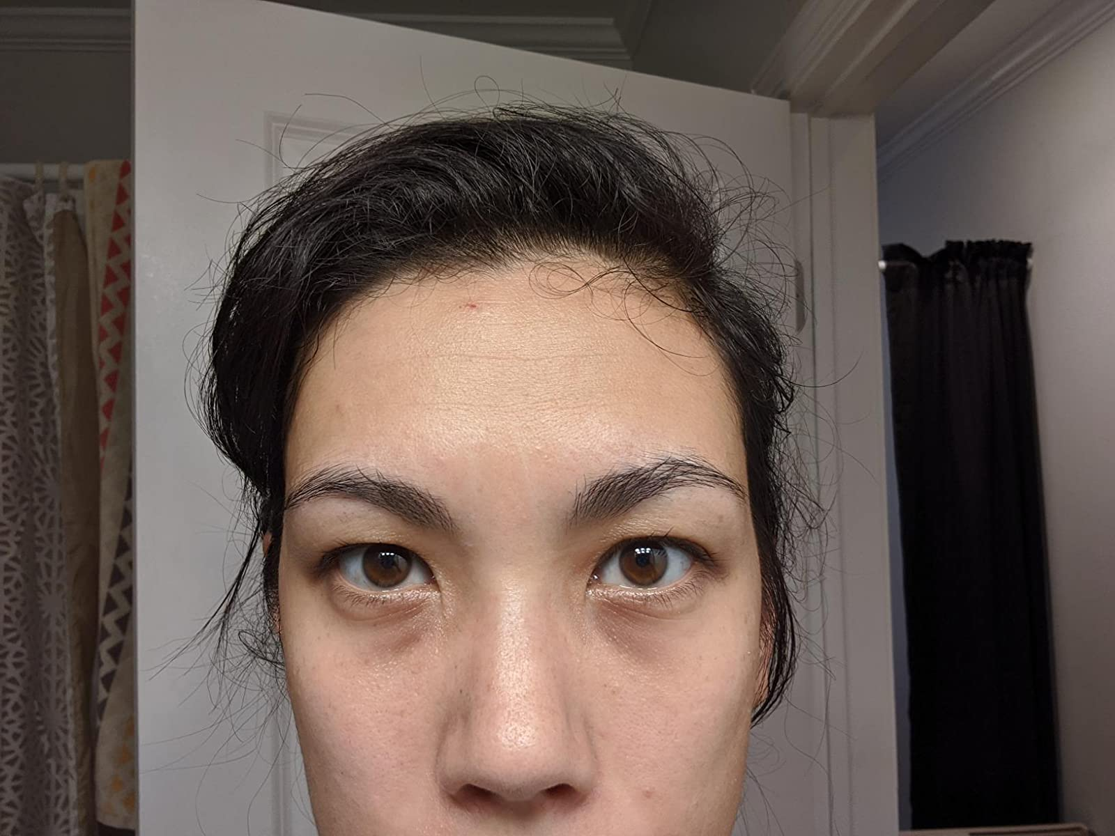 a reviewer photograph  earlier  applying the concealer 