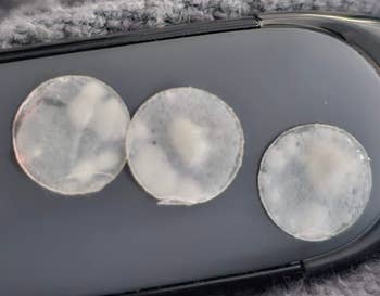 Three clear, utilized circular acne patches connected a telephone case