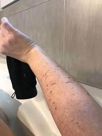 A reviewer's arm covered in dead skin