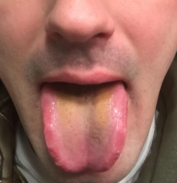 A reviewer's tongue looking yellow
