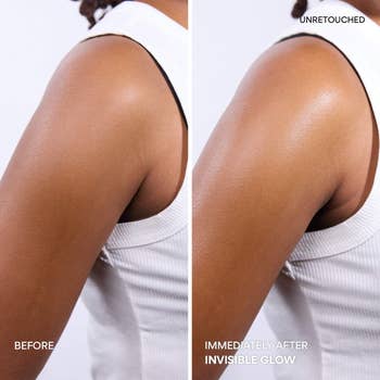 Side-by-side examination  of an limb  earlier  and aft  utilizing Invisible Glow, showing smoother, shinier skin