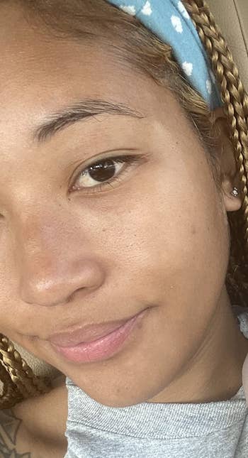 a reviewer with clear skin