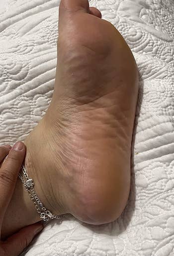 after image of the same reviewer's foot no smooth and callus-free
