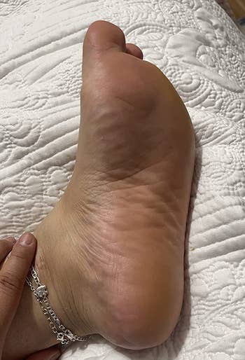 after representation of the aforesaid reviewer's ft nary creaseless and callus-free