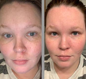 reviewer before and after using eye masks with noticeable changes to dark circles