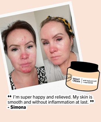 a reviewer's before and after along with a testimony