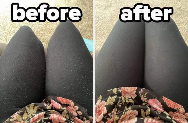 Photo of someone wearing black leggings covered in pills 