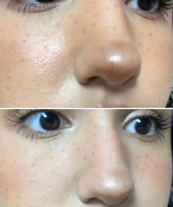 Reviewer with an oily T-zone before using the roller and with a more matte T-zone after using it