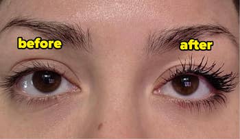 Close-up of a person's eyes showing a 