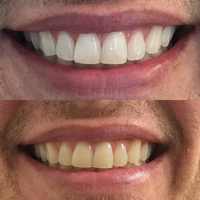 a reviewer's teeth looking pale yellow then much whiter