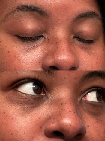 reviewer's close-up before-and-after images of a person's eye area, showing changes in skin texture and eyelid appearance