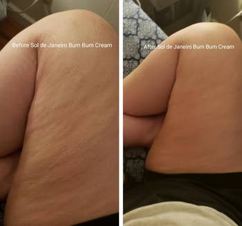 reviewer before and after photo of legs with loose skin before using the cream and legs with tight skin after using the cream
