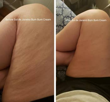 reviewer before and after photo of legs with loose skin before using the cream and legs with tight skin after using the cream