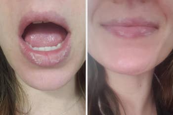 Close-up before and after comparison of a a reviewer's lips showing they are  much less chapped now