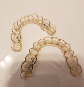 reviewer before photo showing dirty retainer