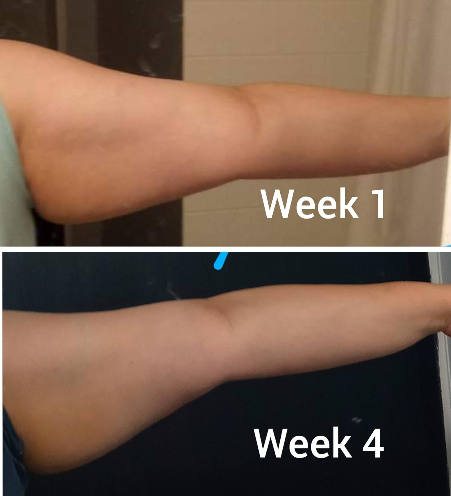 Before and aft  images showing limb  firmness changes implicit    4  weeks, labeled 