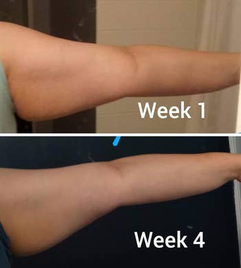 Before and aft images showing limb firmness changes implicit 4 weeks, labeled