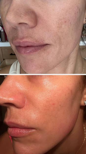 before/after of skin looking brighter after using the serum