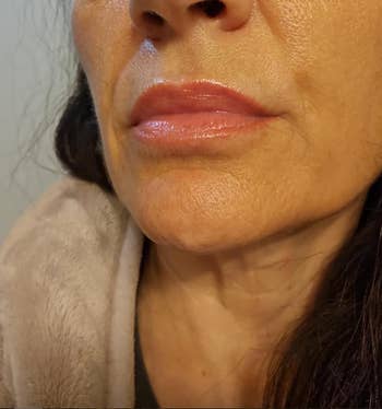 Close-up of a person's face, showing smooth, moisturized lips and skin texture, highlighting skincare product effects