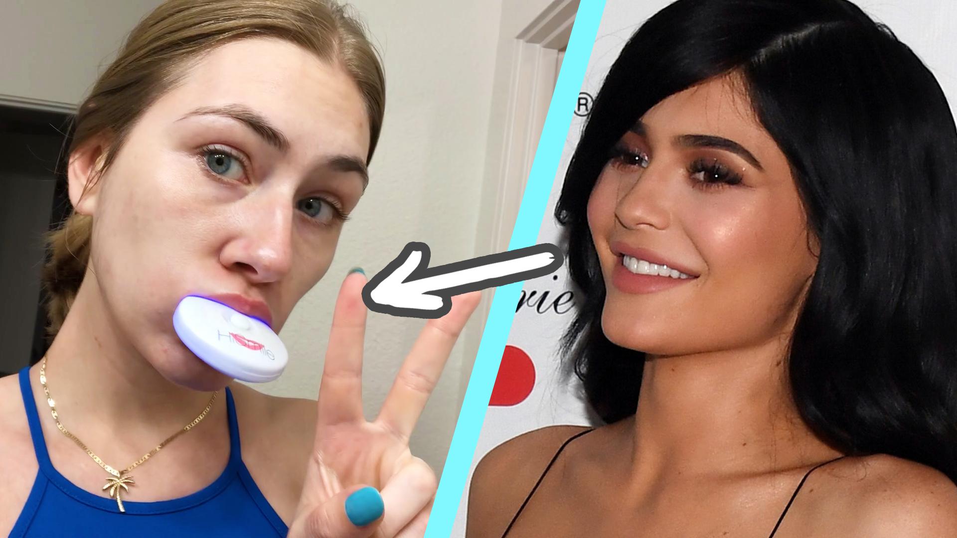 We Tried Kylie Jenner's Teeth Whitening Kit