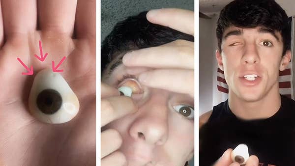 taking out my prosthetic eye and showing you what's behind it 