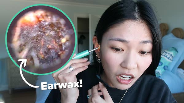 Best Earwax Removal Videos